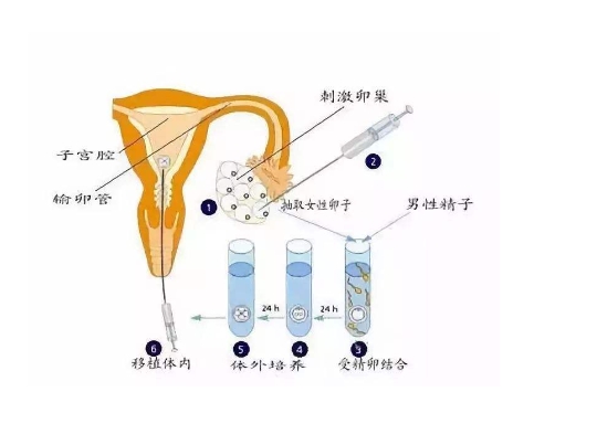 真实的人工授精图片