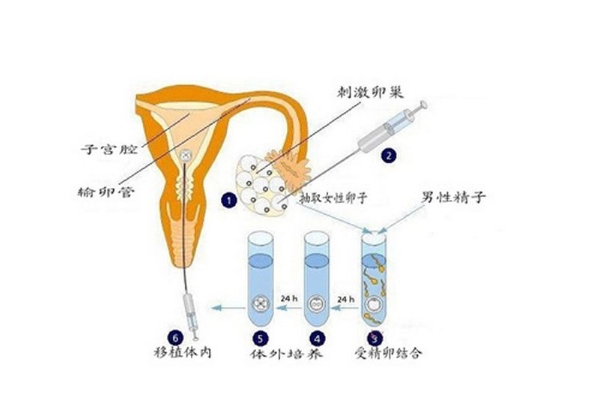 供卵试管婴儿价格费用多少钱