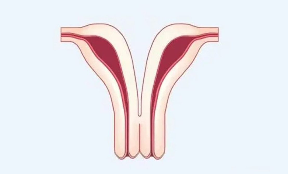 单角子宫可以做泰国试管婴儿吗？为您总结单角子宫试管问题大全！