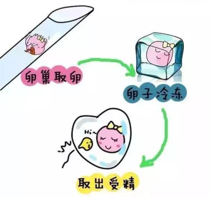 广东做第三代试管婴儿靠谱吗