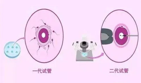 武汉哪个医院可以做三代试管婴儿