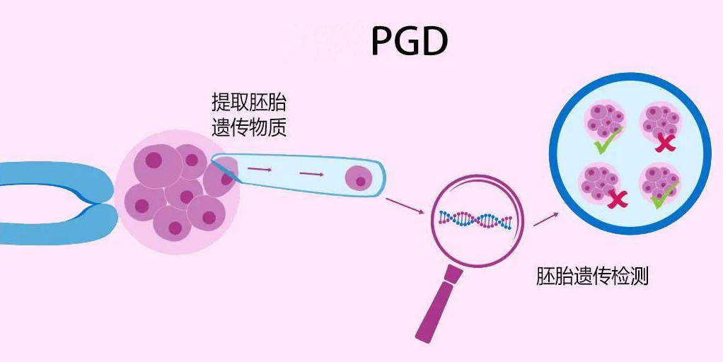 第三代试管婴儿PGD可以筛查出哪些单基因遗传疾病？