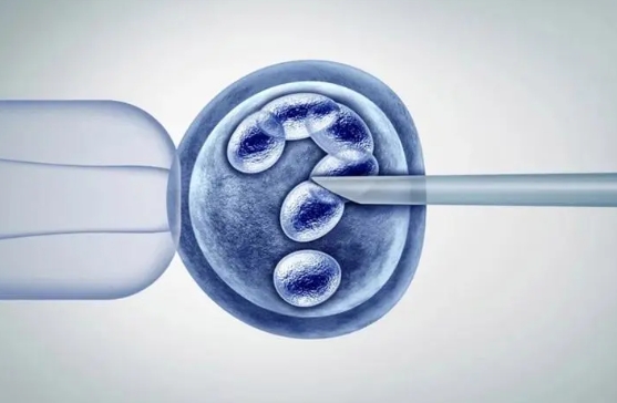 16号染色体异常能正常要孩子吗？三代试管可筛选健康胚胎