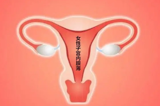 血友病三代试管婴儿可以挑选性别，生男孩能有效避免遗传