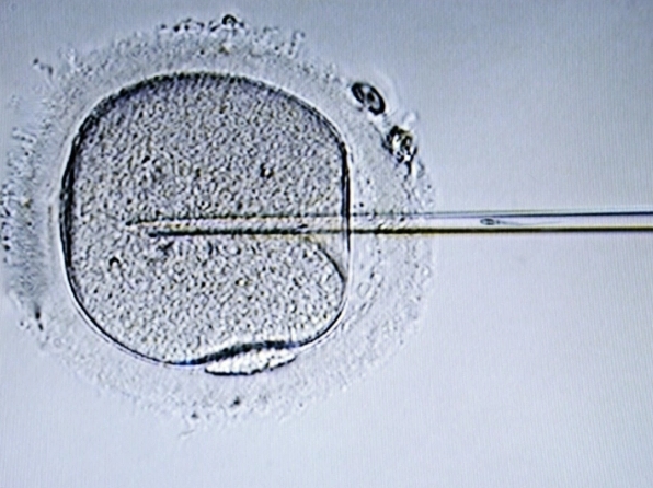 国内三代供精试管的费用明细来了，精子库精子几千就搞定