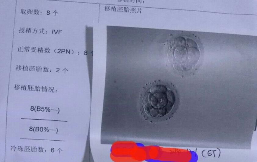 胚胎配的结果，四个A级，四个B级，看到这个结果，顿时信心满满，所承受的苦都值得了，我跟老公商量了下，选择移植2个A级的。其他的冷冻了。