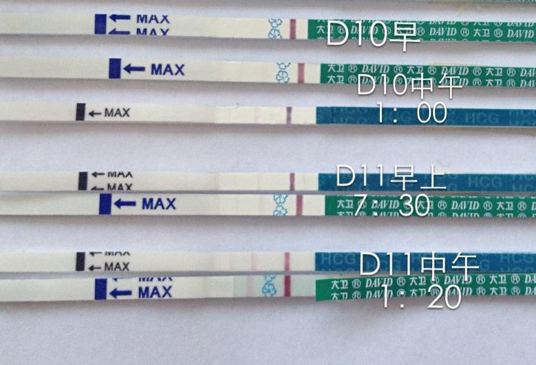 最近这十天都请假在家休息，不给自己压力，其实昨天我已经的测到了两红杠，但太淡了，但是还是比较激动的。再过几天去医院检查下。
