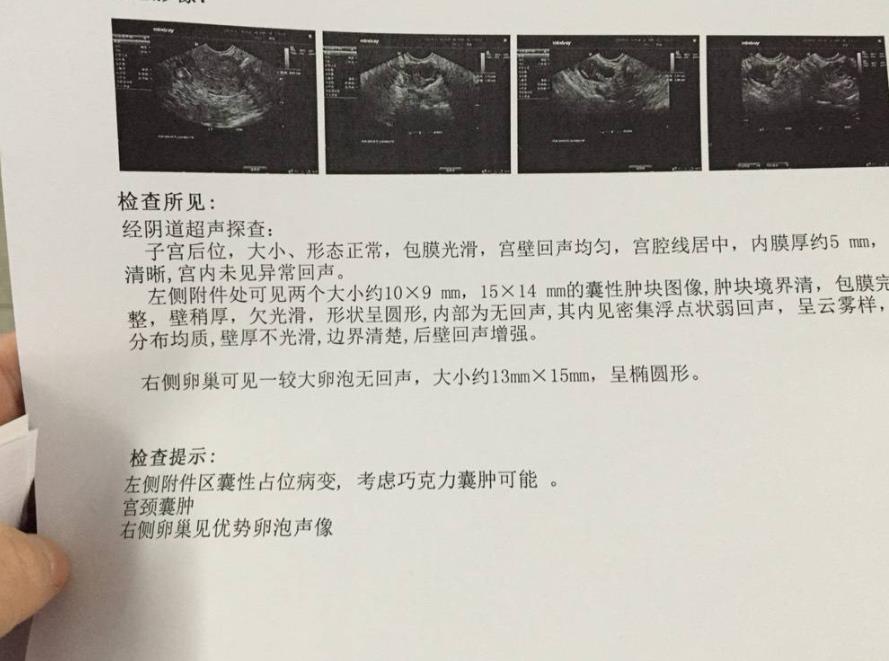 三附院还算是省内一家知名的生殖中心吧，人真的很多，医院人头攒动，还真有点不知道先做什么。好不容易挂上号了， 医生听了我们的情况，让我们做一些检查。我老公轻微的少精弱精。我是输卵管不通，还有巧克力囊肿，囊肿不大，3cm。主治医生说我们可以做试管，可以选择二代，巧囊的问题暂时还好，可以怀孕后再观察。