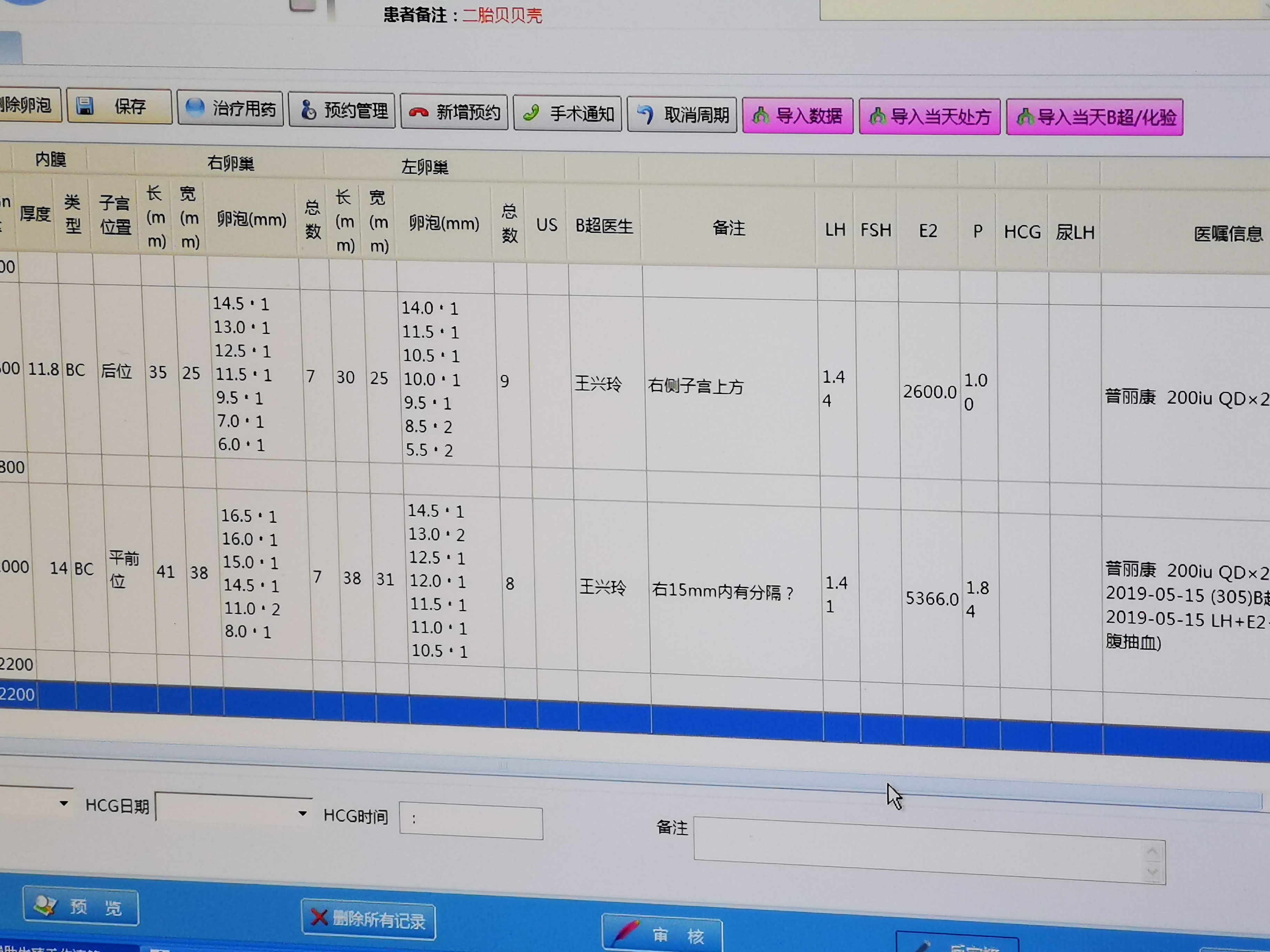 主任说我的卵巢储备功能还不错，再次来了月经后就可以促排了。前天来了月经，开始促排了。我一共促排了12天，一共获取到14枚卵子，培养成11枚胚胎。医生建议我移植两枚鲜胚，其他的都去养囊了。今天顺利移植了2枚胚胎。
