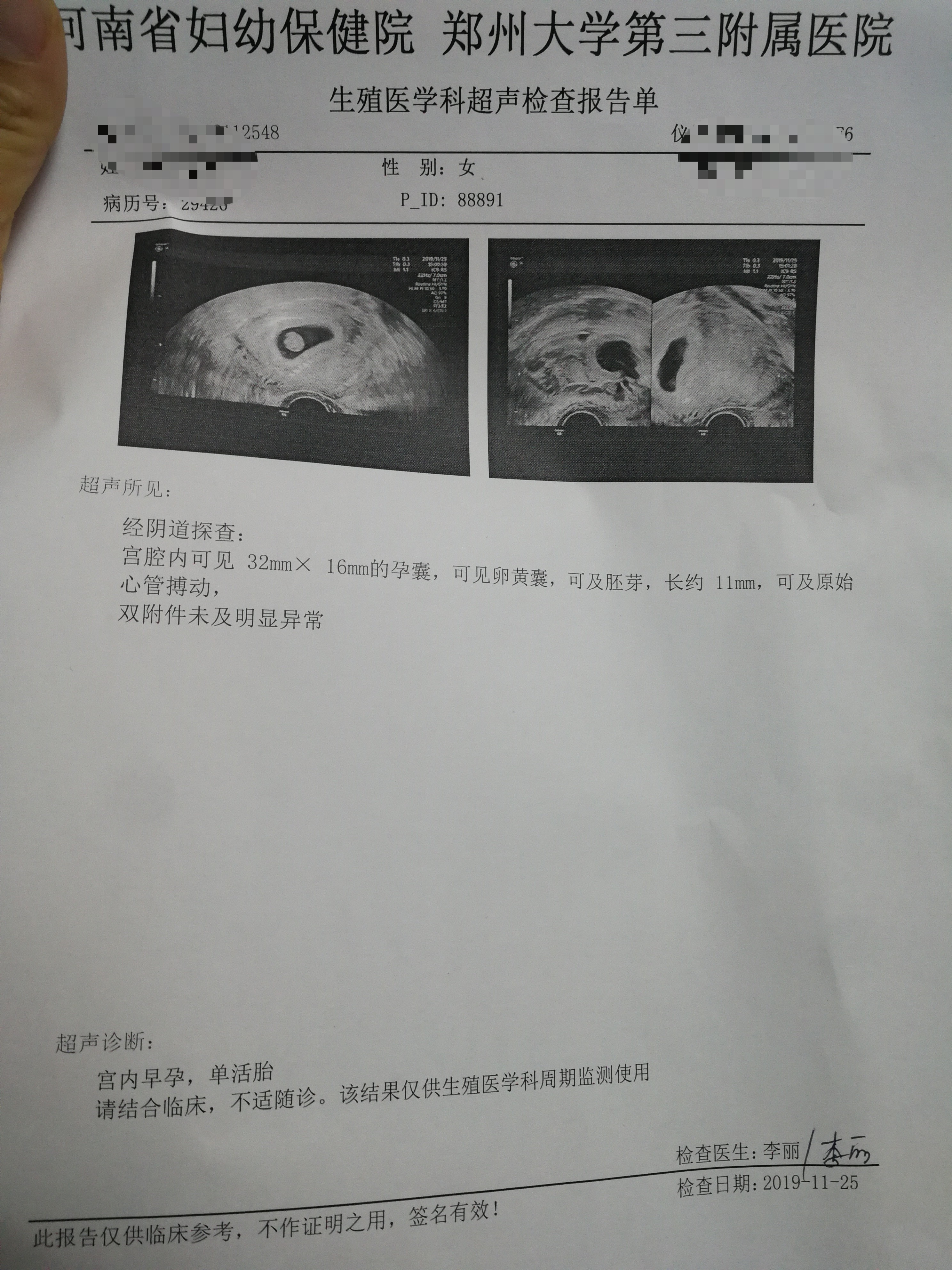 子宫手术,子宫疾病,试管婴儿,输卵管疾病