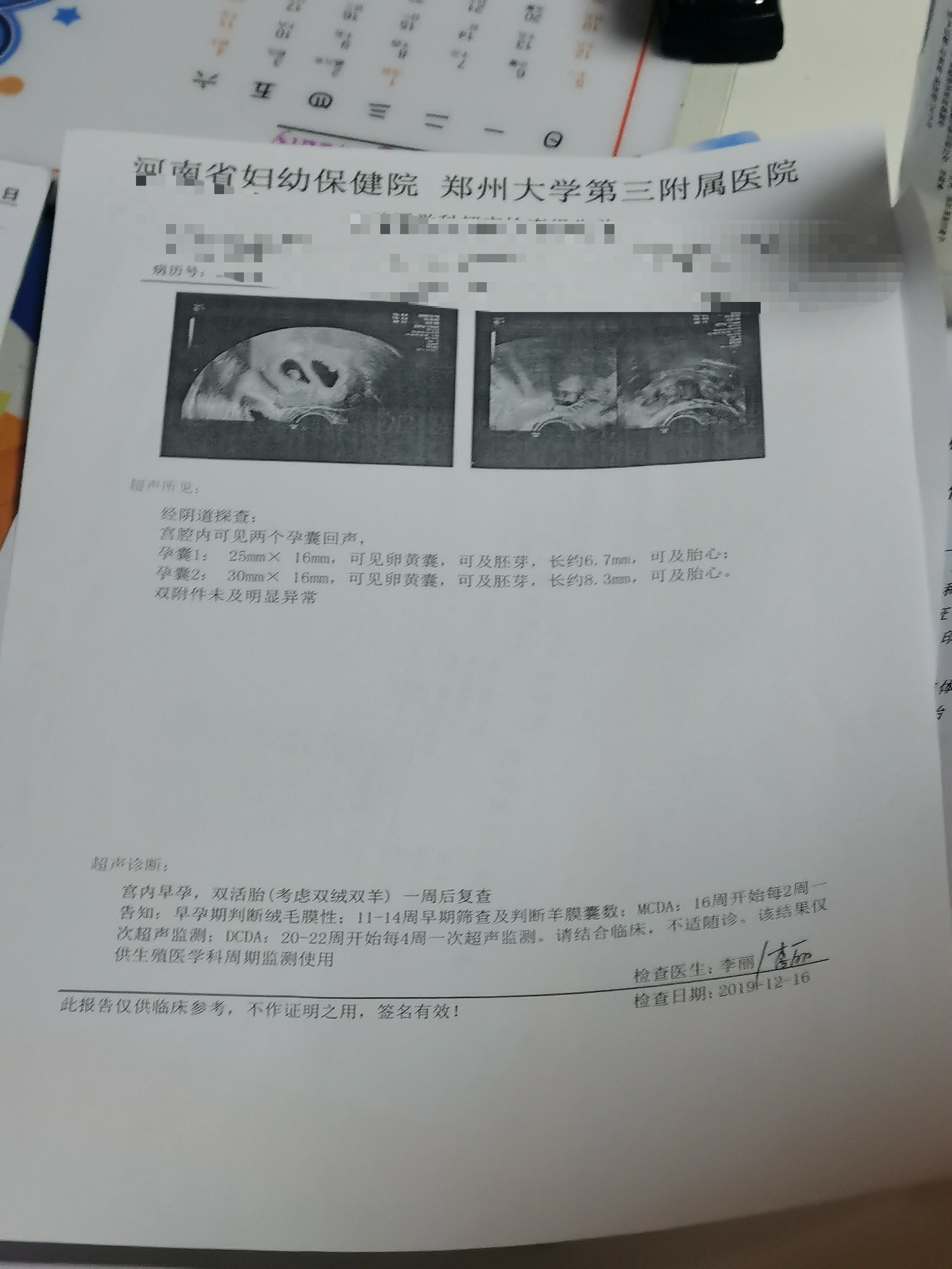 降调，促排，取卵都还算顺利，移植了两个鲜胚，竟然都着床了。真的很幸福，真的没想过能都成，想着成一个就谢天谢地了，生殖顾问也给我说你的心态很好，一次成功也是有应该的，我们的天使终于在我的子宫里安家成长了。在孕期，我也及时向生殖顾问的微信沟通在本地医院检查的情况，在生殖顾问的耐心指导下，安心等待我们宝宝降生了。
