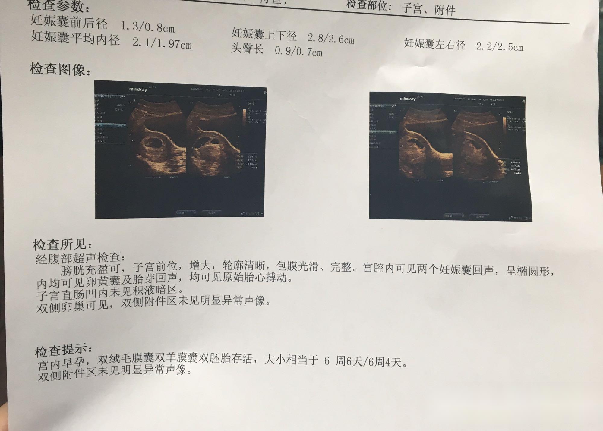 第六天终于忍不住，下午偷偷拿着早孕试纸测了一下，好像有若有若无的浅印，仔细一看又什么都没有，那感觉太折磨人了。我决定管住手，说什么也挨到第十天！于是第十天清楚地看到了中队长！！激动得我都不会说话了！！宝宝来了！！
第十四天血值168，第二十天血值4838，医生说翻倍很好，有可能双胎。双胎，想都不敢想的幸福啊。一超真的看到了两个孕囊，均有胎芽胎心了。宝宝们，谢谢你们选择了我！
