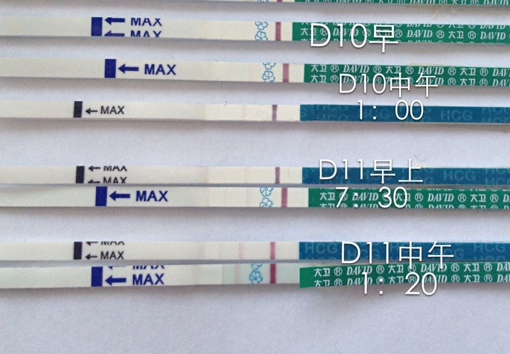 移植后才是煎熬的开始，每天都不受控制的胡思乱想，处处小心，各种百度，咨询，一点风吹草动都无法安心，整天自己吓自己，尤其是看到同期的人测到而自己没有，以及家里所有人都满含期望等你的消息，最怕的就是老公的态度，我家那位非常非常极度想要孩子，在移植第4天就开始闹了小乌龙：由于多年基本没有用过验孕棒，并且从未双杠过，我从第4天开始测，一度认为没有中，直到第8天刚开始白板绝望扔到一边，洗漱完想收起来才看到隐约的双杠！！当即我又换了一支新的从新测试，确认了不是炸糊随即翻出前几天验孕棒仔细查看，发现从第5天开始就有意念灰，我是多么的马大哈，也难为我肚子里的4AA胚胎了，这几天跟着我心情反反复复，各种落泪猜疑。