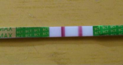 今天的太阳真耀眼啊，我感觉一切都不同了！因为试纸出现了两条杠，两条杠！

老公和婆婆都哽咽了，却一直劝我说，赶快坐下来好好休息，别乱动了。

通知生殖管家，生殖管家也非常高兴，交代这些天要注意饮食和休息，来医院检查一下血值。

马上就去医院了，抽完血后要下午才能看结果！迫切的等待了漫长的几个小时，终于拿到结果，HCG4000多。医生说血值特别好，有很大可能是双胎。

婆婆激动的都哭了，她说一定是老天不忍心看我再受罪，一次让我得到两个宝宝。唉，老人是真心疼我。