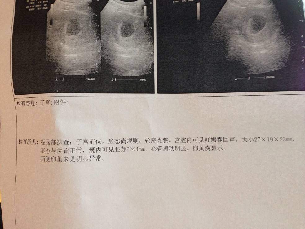 昨天一大早我就来了医院，看了看胎心胎芽，顺便计算预产期！！啊啊啊啊我真的要开心死了！！！ 感谢平台。姐妹们真的真的不要放弃！！失败多少次结果再差都不要放弃！还有就是运动真的有用！！虽然苦又累很难坚持但是真的真的有用！！从我决定好好振作调养到进周促排中间差不多快4个月, 每天运动至少3小时早上瑜伽晚上帕梅拉, 戒糖戒面食戒碳水化合物, 少油少盐多吃高蛋白维生素和含膳食纤维的食物, 主食基本是粗粮紫薯玉米山药芋头. 每天晚上11点左右就睡觉(怕自己做不到早睡我专门报了早上7.30的网上瑜伽课逼自己早睡早起)。就这样将近四个月时间合理瘦了16kg。 备孕药方面就是吃红妥+线立体+日本蒲公英茶+叶酸。