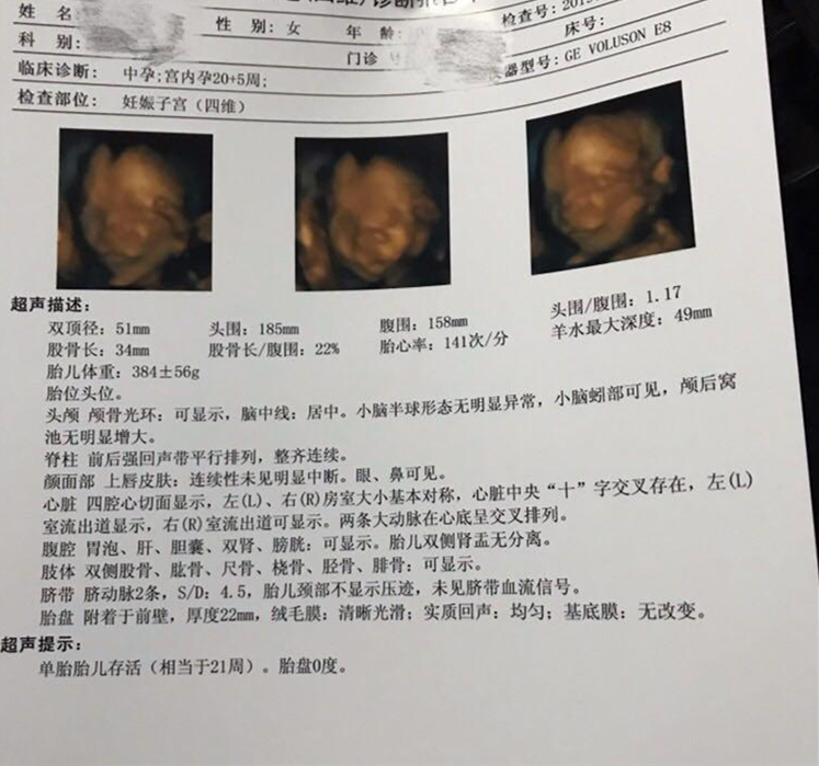 精液疾病,输卵管疾病